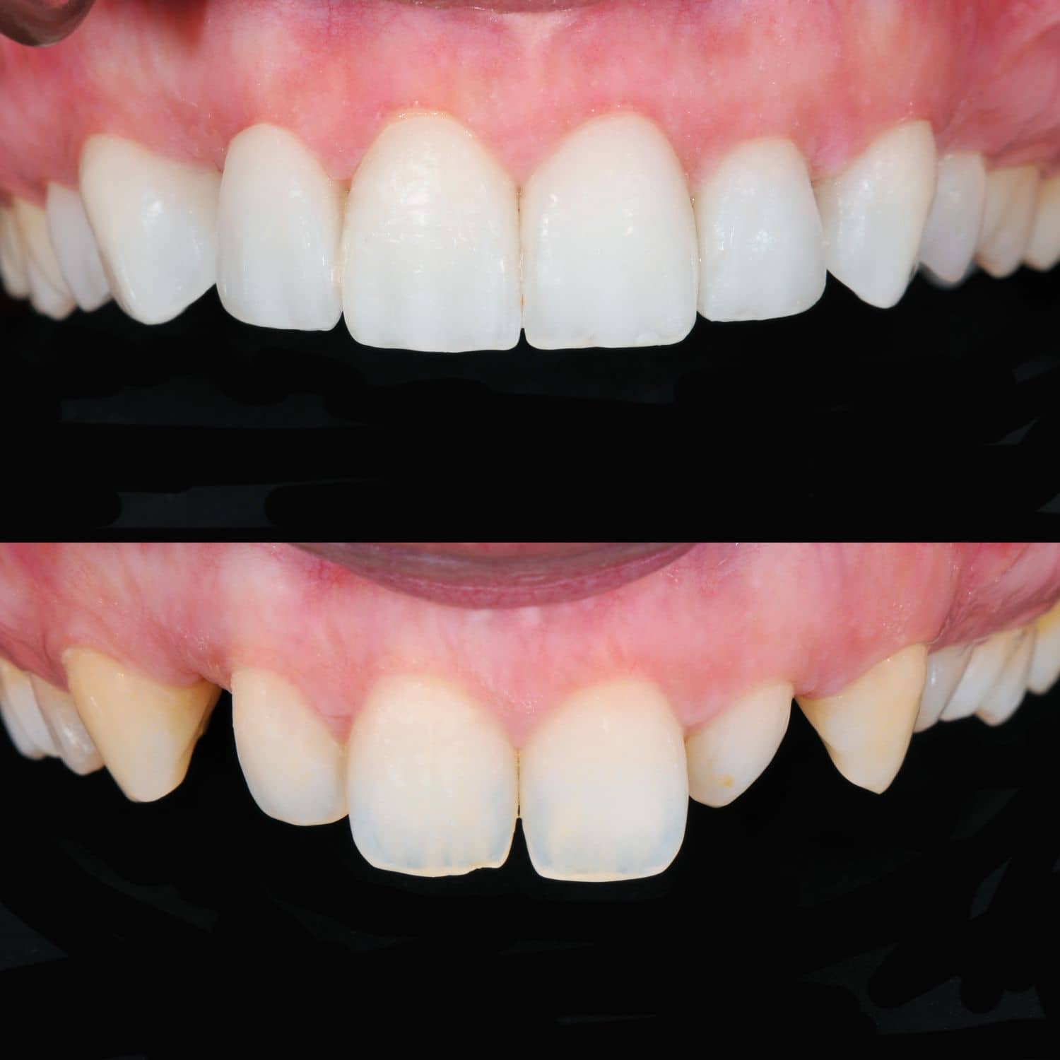 estetica-dental estética dental en maipú